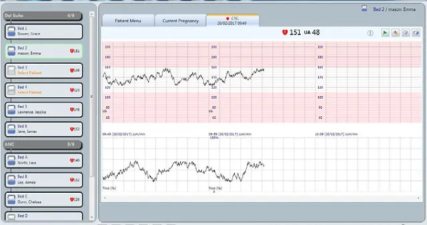Sonicaid Centrale Hospital System – Sonicaid Centrale  CTG Viewing & Archiving SystemHospital/Server Based System - Image 3